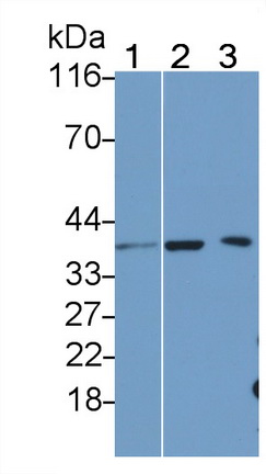 白介素1β(IL1b)多克隆抗体