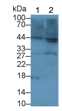 白介素1β(IL1b)多克隆抗體