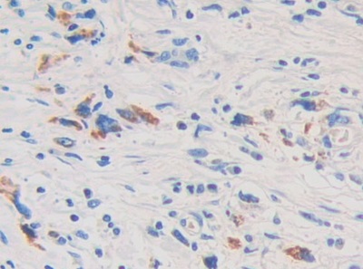 白介素1δ(FIL1d)多克隆抗體