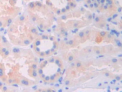 白介素1δ(FIL1d)多克隆抗體