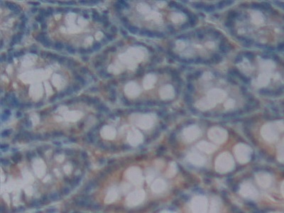 白介素1δ(FIL1d)多克隆抗體