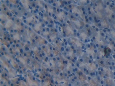 白介素1δ(FIL1d)多克隆抗體