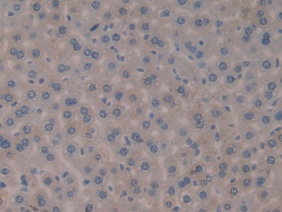 白介素1δ(FIL1d)多克隆抗體