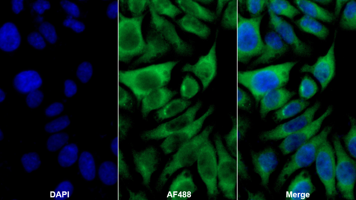磷脂酶A2激活蛋白(PLAP)多克隆抗體