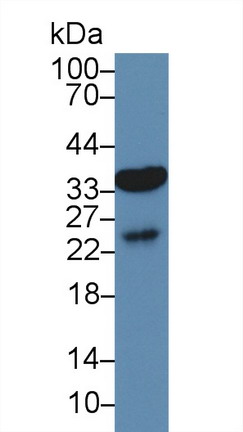 水通道蛋白9(AQP9)多克隆抗體