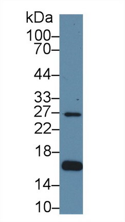 水通道蛋白2(AQP2)多克隆抗體