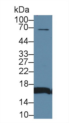 水通道蛋白2(AQP2)多克隆抗體