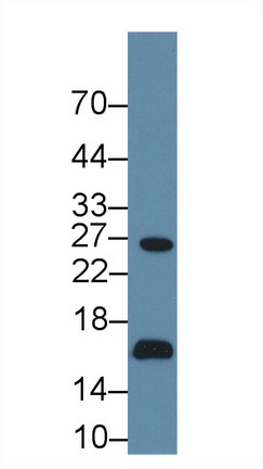 水通道蛋白2(AQP2)多克隆抗體