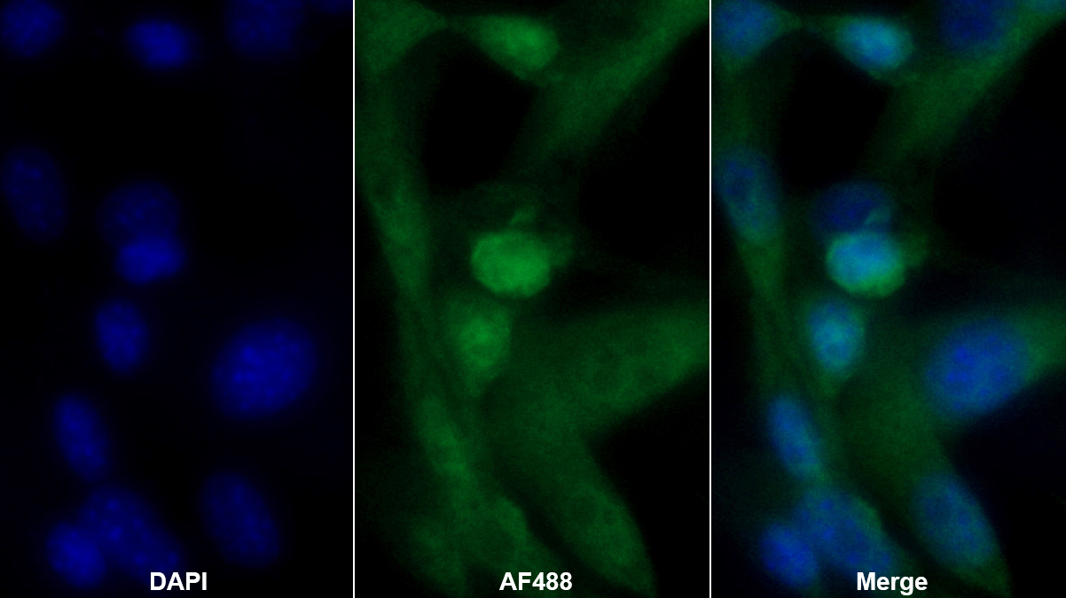 細(xì)胞周期素D1(CCND1)多克隆抗體