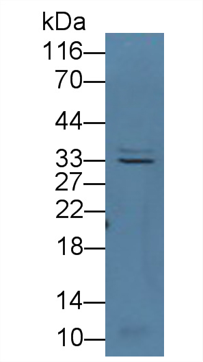 细胞周期素D3(CCND3)多克隆抗体