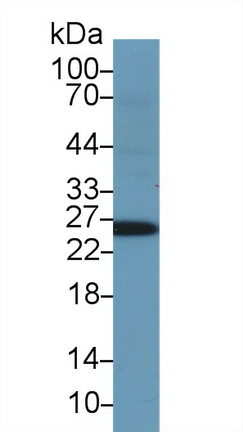 谷胱甘肽S轉(zhuǎn)移酶α1(GSTa1)多克隆抗體