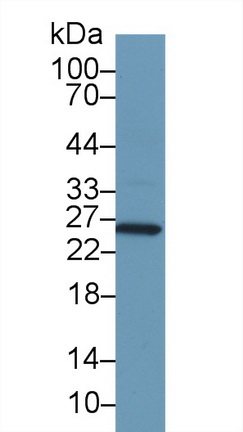 谷胱甘肽S轉(zhuǎn)移酶α1(GSTa1)多克隆抗體