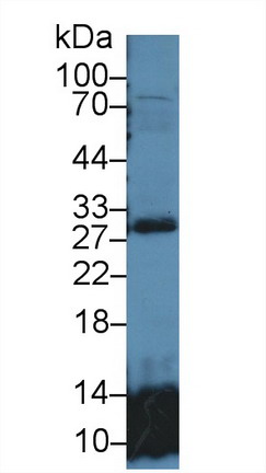 谷胱甘肽S转移酶θ2(GSTt2)多克隆抗体