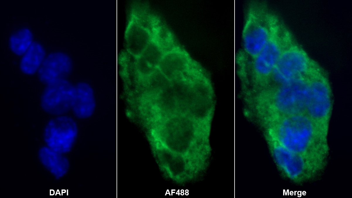 羧肽酶B2(CPB2)多克隆抗體