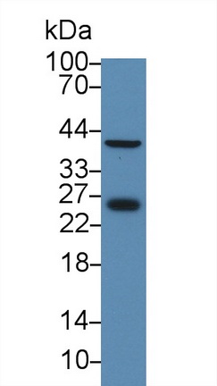 谷胱甘肽S转移酶θ1(GSTt1)多克隆抗体