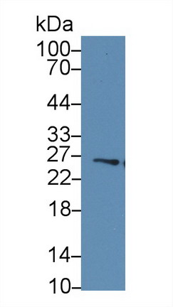 谷胱甘肽S转移酶μ4(GSTm4)多克隆抗体