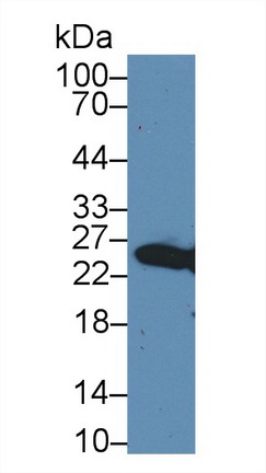 谷胱甘肽S转移酶μ4(GSTm4)多克隆抗体