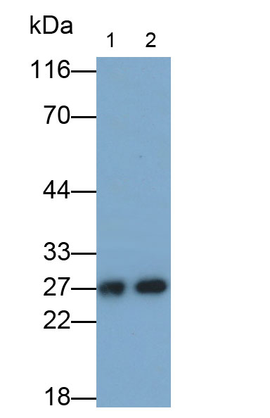 谷胱甘肽S转移酶μ4(GSTm4)多克隆抗体