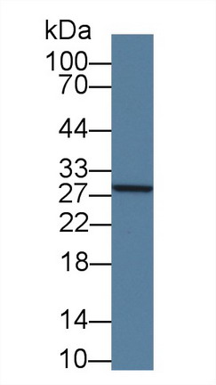 谷胱甘肽S转移酶μ4(GSTm4)多克隆抗体