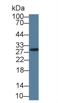 谷胱甘肽S转移酶μ4(GSTm4)多克隆抗体