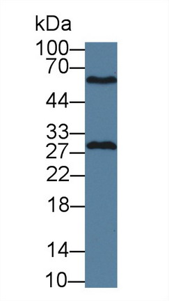 谷胱甘肽S转移酶μ4(GSTm4)多克隆抗体