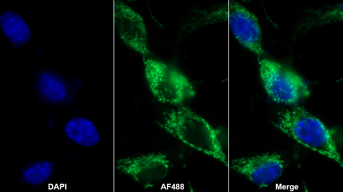 透明質(zhì)酸結(jié)合蛋白1(C1QBP)多克隆抗體