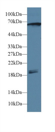 钙/钙调蛋白依赖性蛋白激酶Ⅱγ(CAMK2g)多克隆抗体