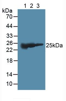 谷胱甘肽S转移酶μ2(GSTM2)多克隆抗体