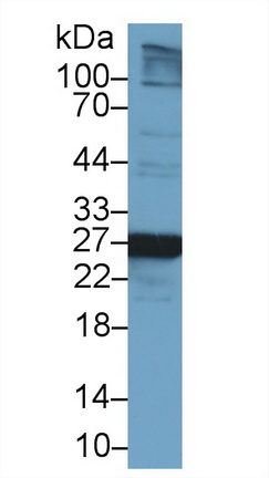 谷胱甘肽S转移酶μ2(GSTM2)多克隆抗体