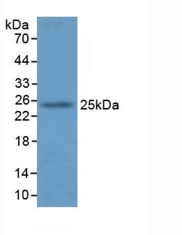 谷胱甘肽S轉(zhuǎn)移酶α4(GSTA4)多克隆抗體