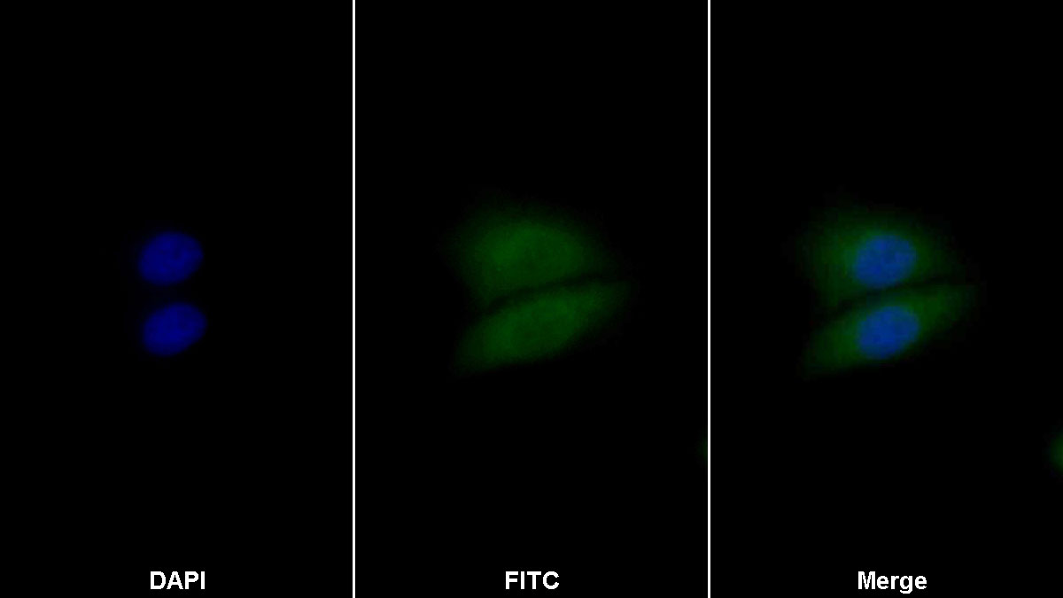 酪蛋白激酶1α1(CSNK1a1)多克隆抗体