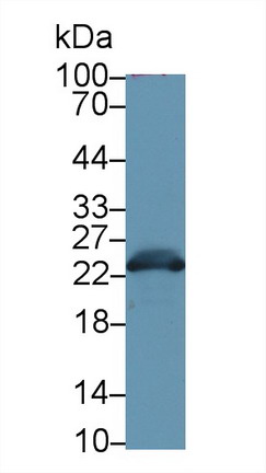 谷胱甘肽S轉(zhuǎn)移酶α3(GSTa3)多克隆抗體