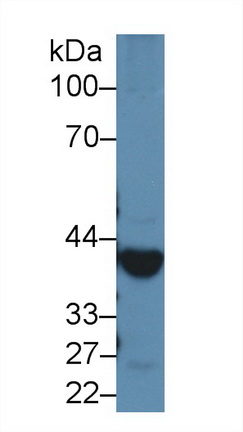 乙醇脱氢酶1(ADH1)多克隆抗体