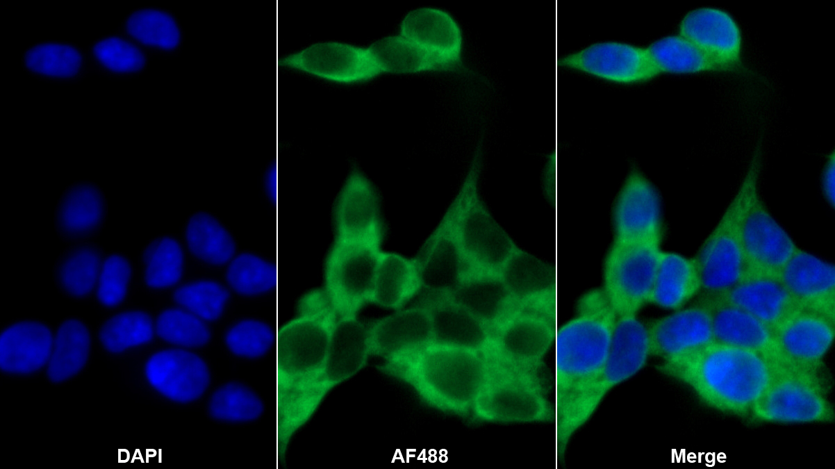 激肽釋放酶8(KLK8)多克隆抗體