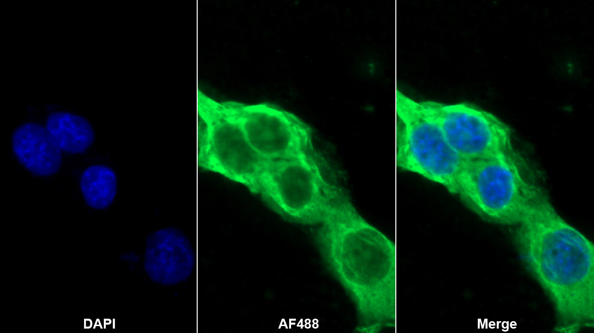 巨噬细胞移动抑制因子(MIF)多克隆抗体