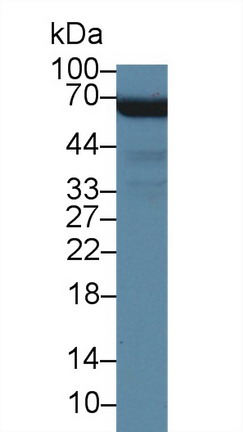 棕榈酰化膜蛋白6(MPP6)多克隆抗体