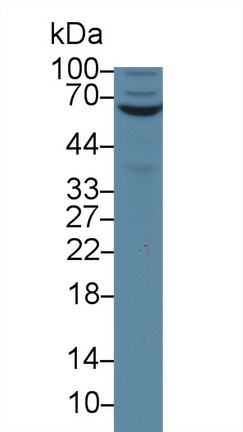 棕榈酰化膜蛋白6(MPP6)多克隆抗体