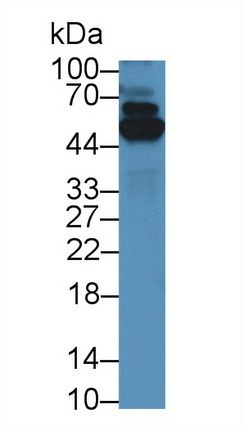 硫氧还蛋白还原酶1(TXNRD1)多克隆抗体