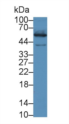 硫氧还蛋白还原酶1(TXNRD1)多克隆抗体