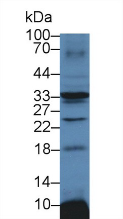 钠/钾离子转运ATP酶β3肽(ATP1b3)多克隆抗体