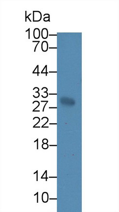 钠/钾离子转运ATP酶β3肽(ATP1b3)多克隆抗体