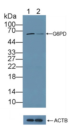 葡萄糖6磷酸脱氢酶(G6PD)多克隆抗体