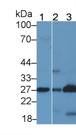 前列腺素D2合成酶(PTGDS)多克隆抗体