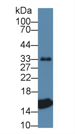 轉(zhuǎn)甲狀腺素蛋白(PALB)多克隆抗體