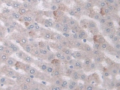 環(huán)加氧酶1(COX-1)多克隆抗體