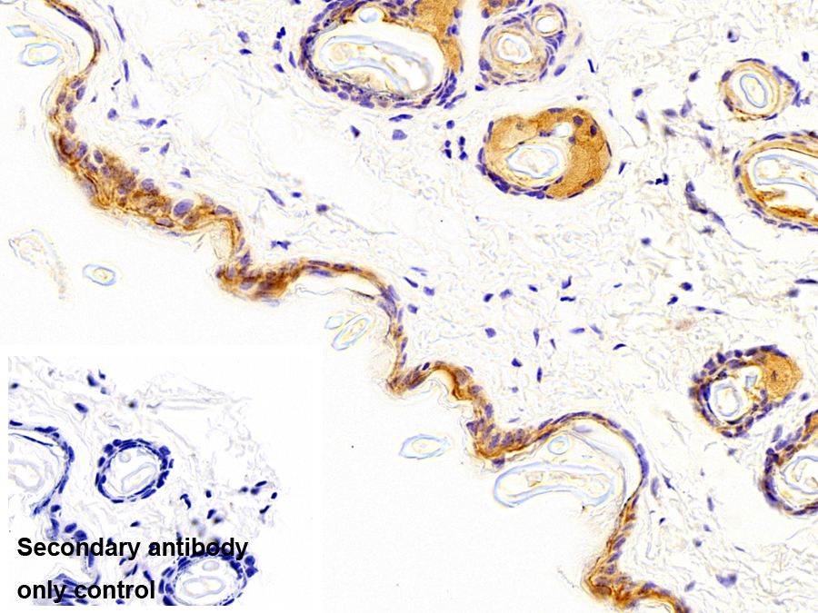 橋粒芯糖蛋白1(DSG1)多克隆抗體
