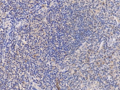 CD38分子(CD38)多克隆抗體