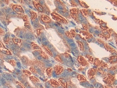 CD38分子(CD38)多克隆抗体