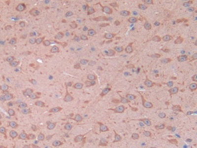 CD38分子(CD38)多克隆抗体