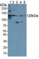补体C3转化酶(C3 Convertase)多克隆抗体